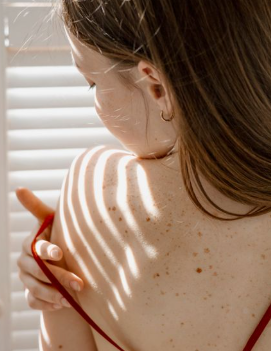 What Causes Red Pimples and Pustules on the Back and Shoulders?