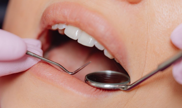 What Helps Reduce Dental Plaque? Natural Oral Care Tips
