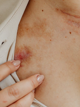 9 Possible Reasons You May Experience Persistent Itching